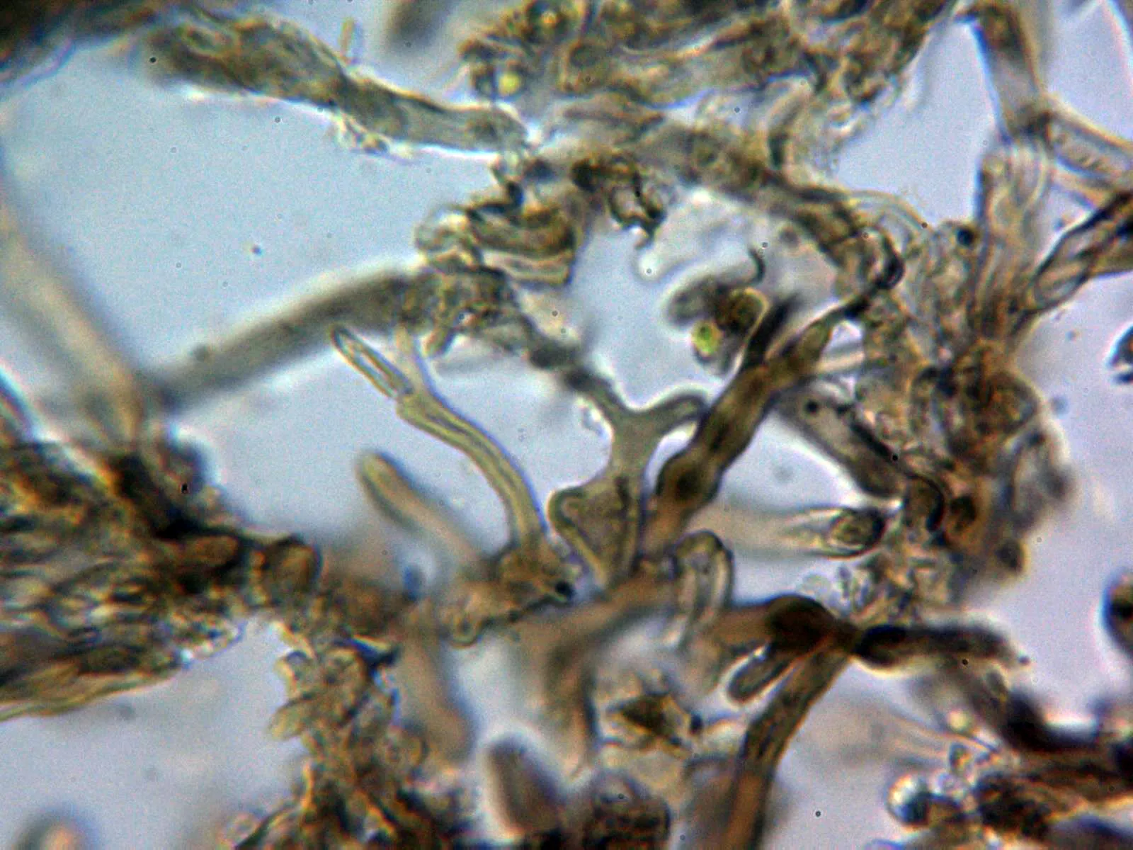 Microscopía de Peniophora versiformis - 12 - Hifas HOH 1